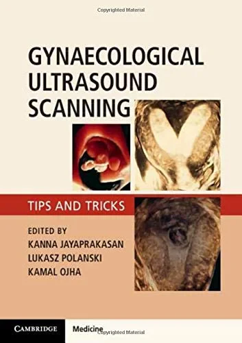 Coperta cărții "Gynaecological Ultrasound Scanning: Tips and Tricks" de Kanna Jayaprakasan, Lukasz Polanski, Kamal Ojha