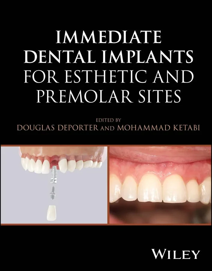Immediate Dental Implants for Esthetic and Premola...