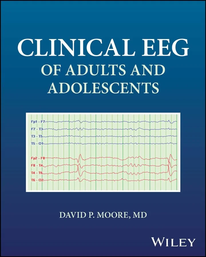 Coperta cărții "Clinical EEG of Adults and Adolescents 1st Edition" de David P. Moore
