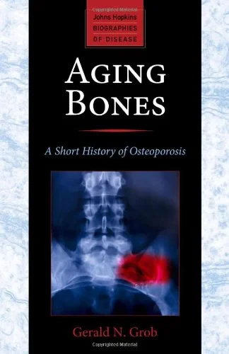 Coperta cărții "Aging Bones, A Short History of Osteoporosis" de Grob Gerald N.