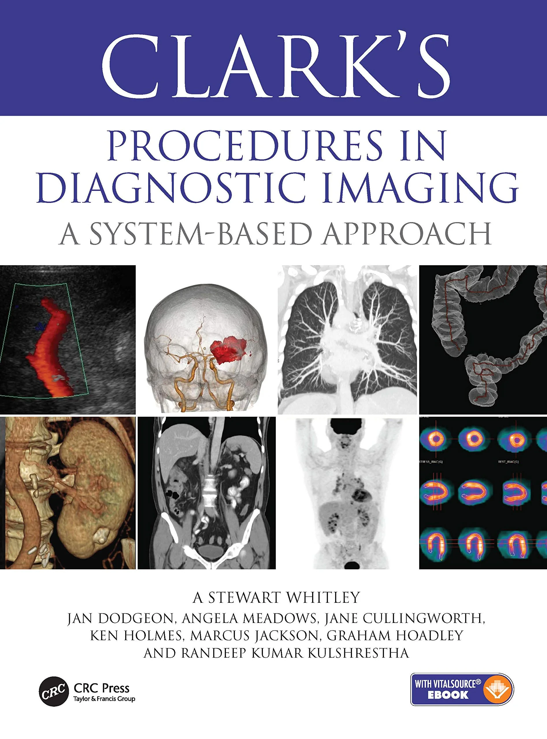 Coperta cărții "Clark’s Procedures in Diagnostic Imaging: A System-Based Approach " de Stewart A Whitley, Jan Dodgeon, Angela Meadows, Jane Cullingworth