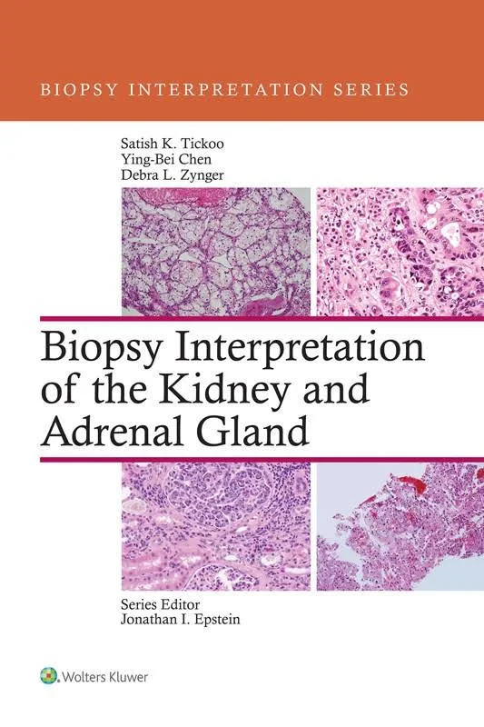 Coperta cărții "Biopsy Interpretation of the Kidney &amp; Adrenal Gland " de Satish Tickoo, Ying-Bei Chen and Debra Zynger
