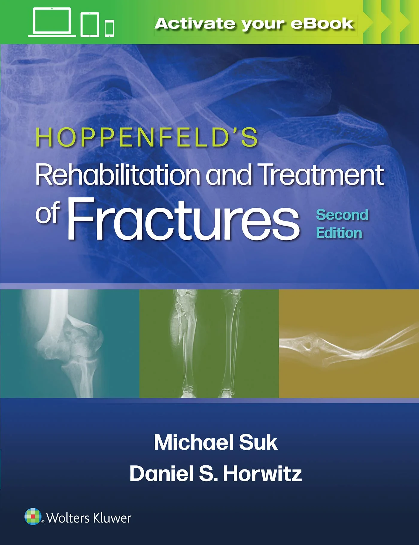 Coperta cărții "Hoppenfeld’s Treatment and Rehabilitation of Fractures" de Michael Suk