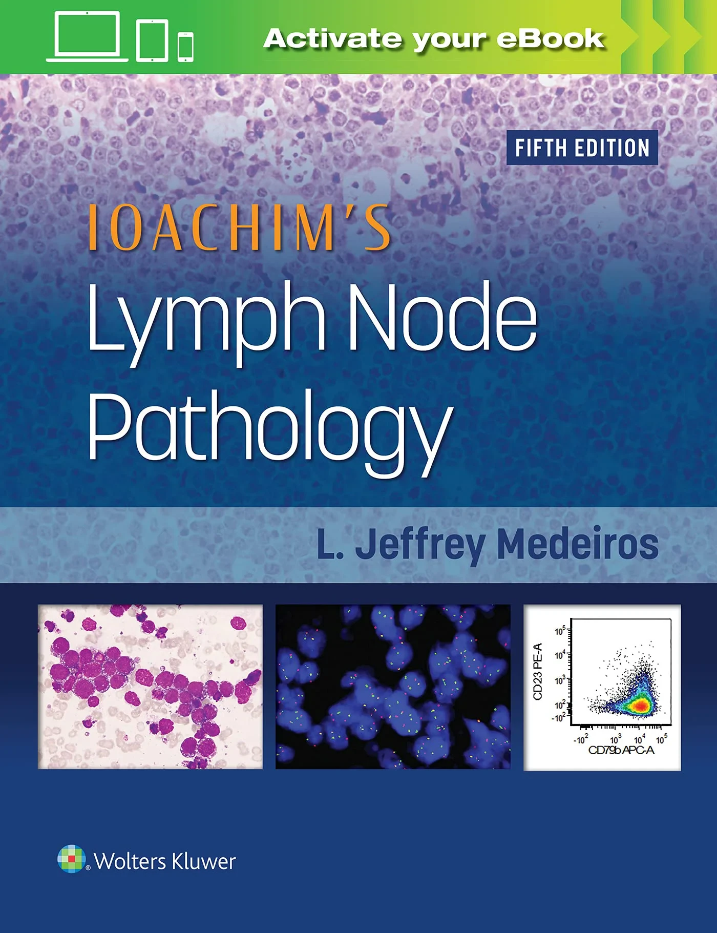 Ioachim’s Lymph Node Pathology