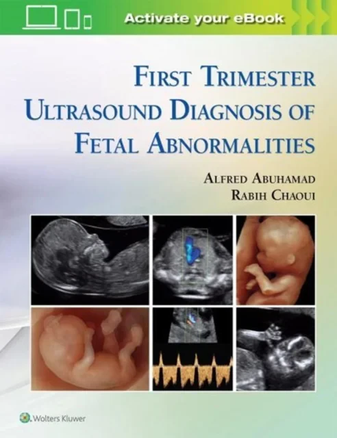 Coperta cărții "First Trimester Ultrasound Diagnosis of Fetal Abnormalities " de Alfred Z. Abuhamad, Rabih Chaoui