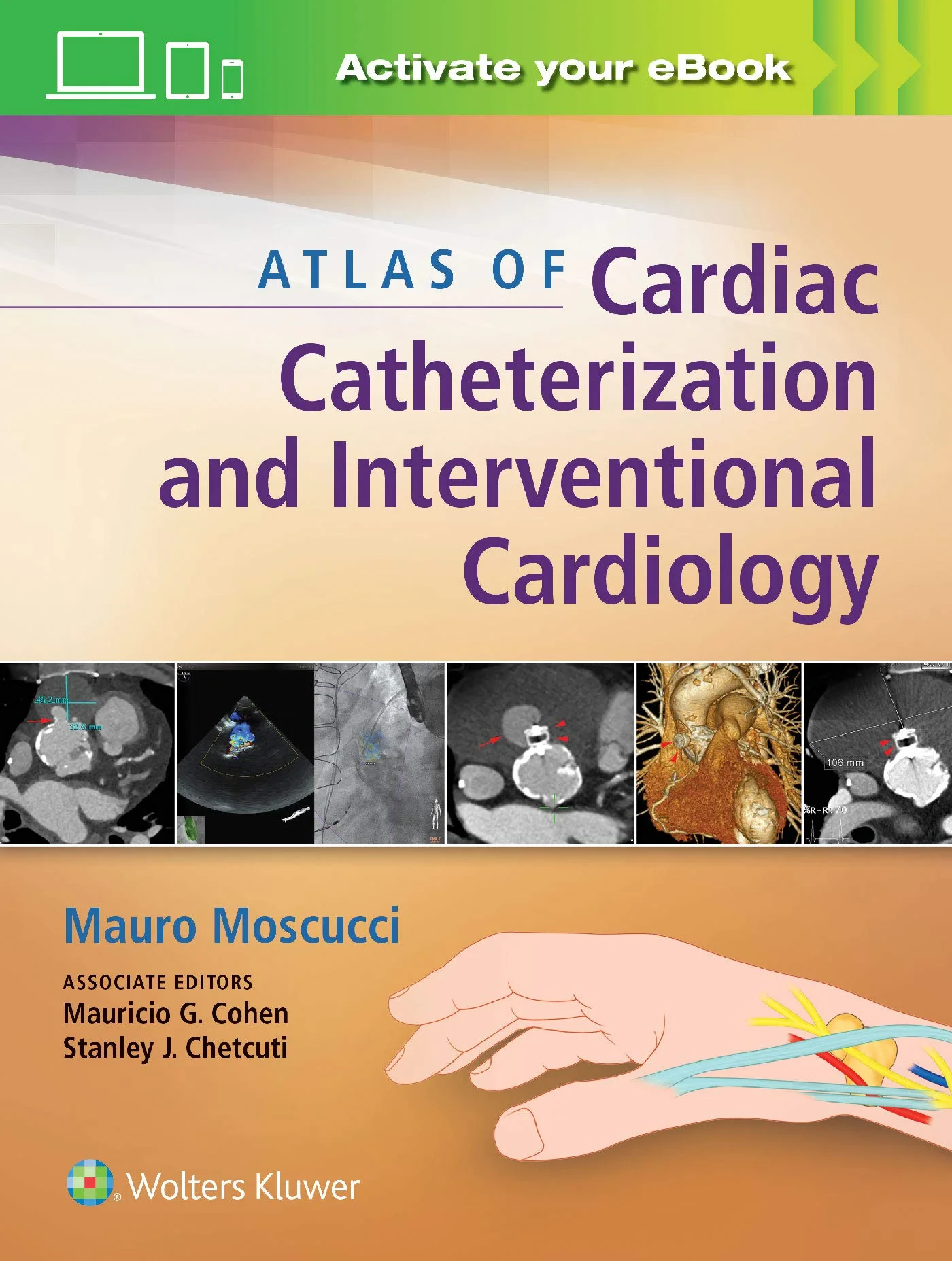 Coperta cărții "Atlas of Cardiac Catheterization and Interventional Cardiology: Practical Images for Diagnosis and Ablation " de Mauro Moscucci, Mauricio G Cohen MD FACC FSCAI, Stanley J Chetcuti MD