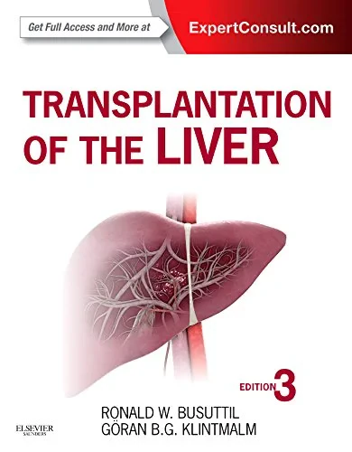 Coperta cărții "Transplantation of the Liver: Expert Consult - Online and Print, 3e" de Busuttil &amp;  Klintmalm