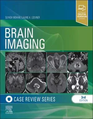 Coperta cărții "Brain Imaging: Case Review Series" de Suyash Mohan, Laurie A. Loevner
