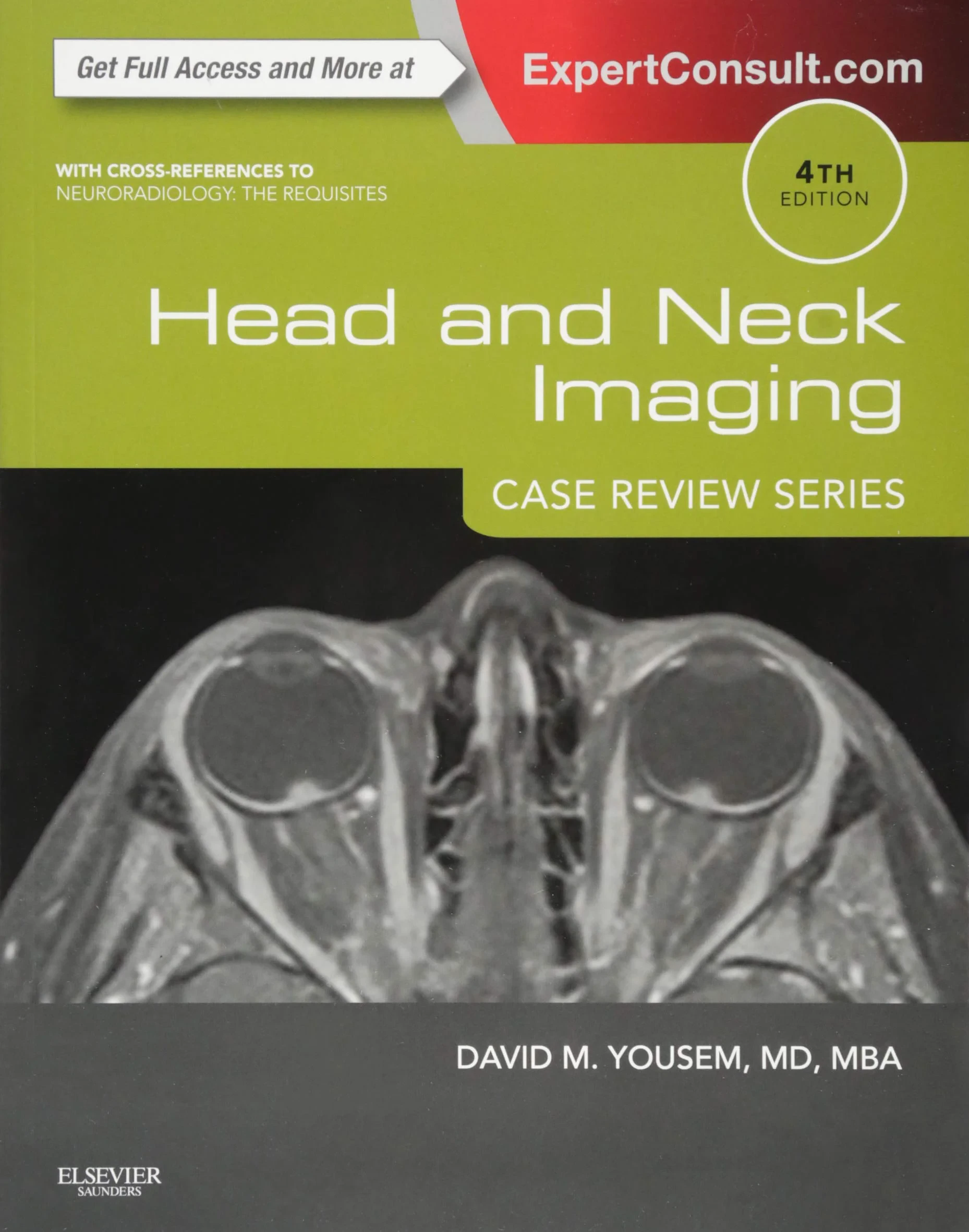 Coperta cărții "Head and Neck Imaging: Case Review Series, 4th Edition" de Yousem