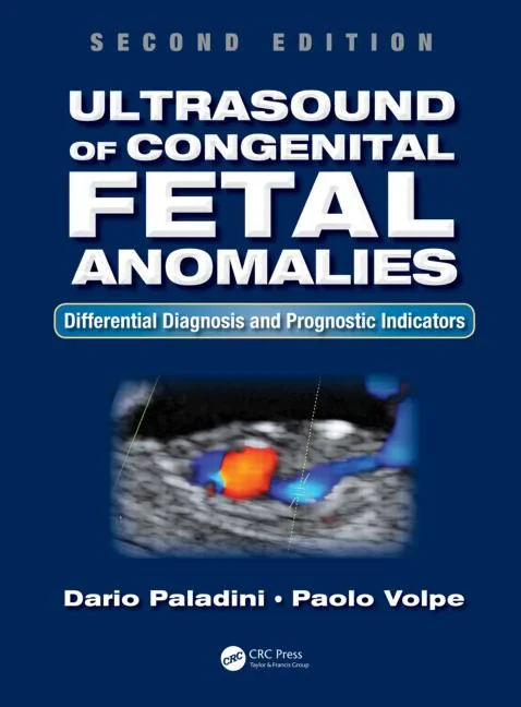 Ultrasound of Congenital Fetal Anomalies: Differen...