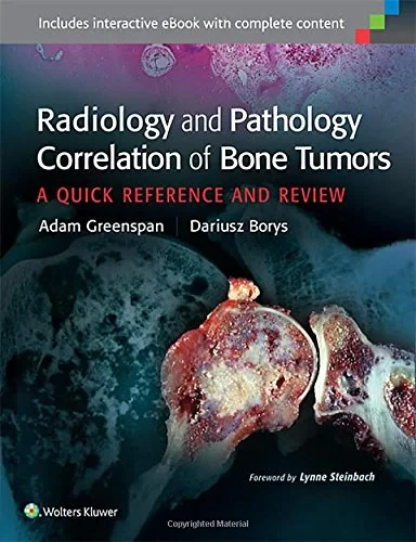 Coperta cărții "Radiology and Pathology Correlation of Bone Tumors" de Adam Greenspan and Dariusz Borys