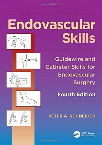 Endovascular Skills: Guidewire and Catheter Skills...