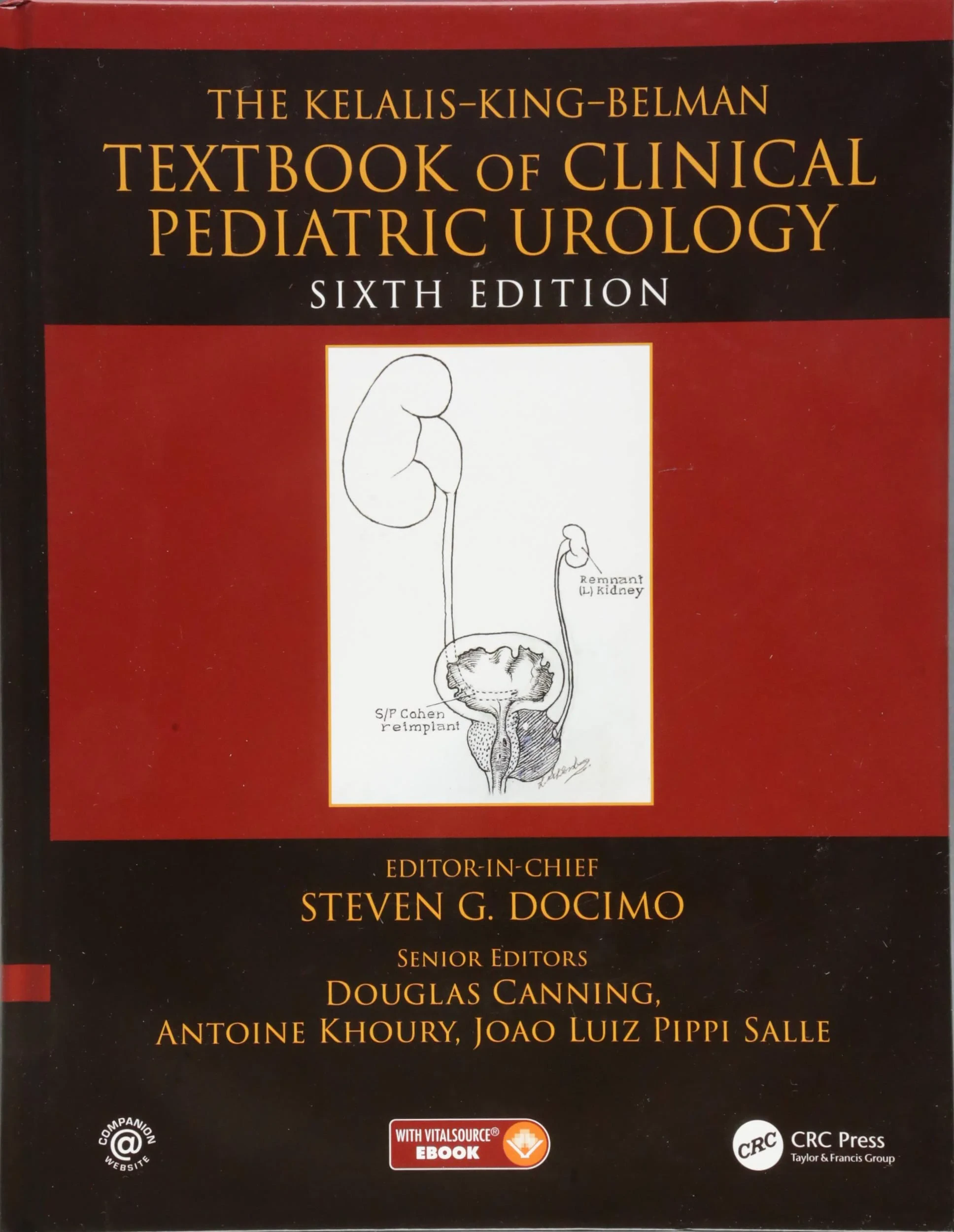 The Kelalis--King--Belman Textbook of Clinical Ped...