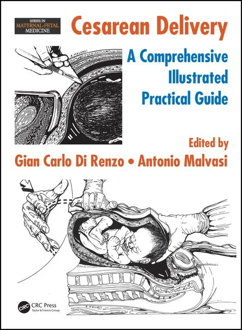 Cesarean Delivery: A Comprehensive Illustrated Pra...