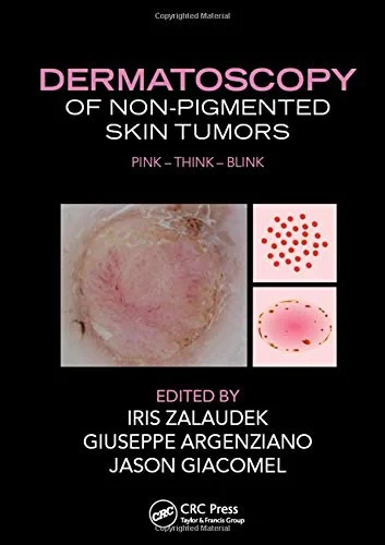 Coperta cărții "Dermatoscopy of Non-Pigmented Skin Tumors" de Iris Zalaudek, Giuseppe Argenziano, Jason Giacomel