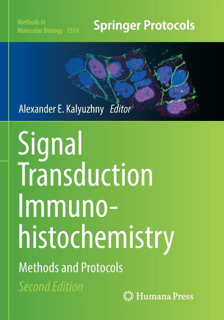 Coperta cărții "Signal Transduction Immunohistochemistry: Methods and Protocols " de Alexander E. Kalyuzhny