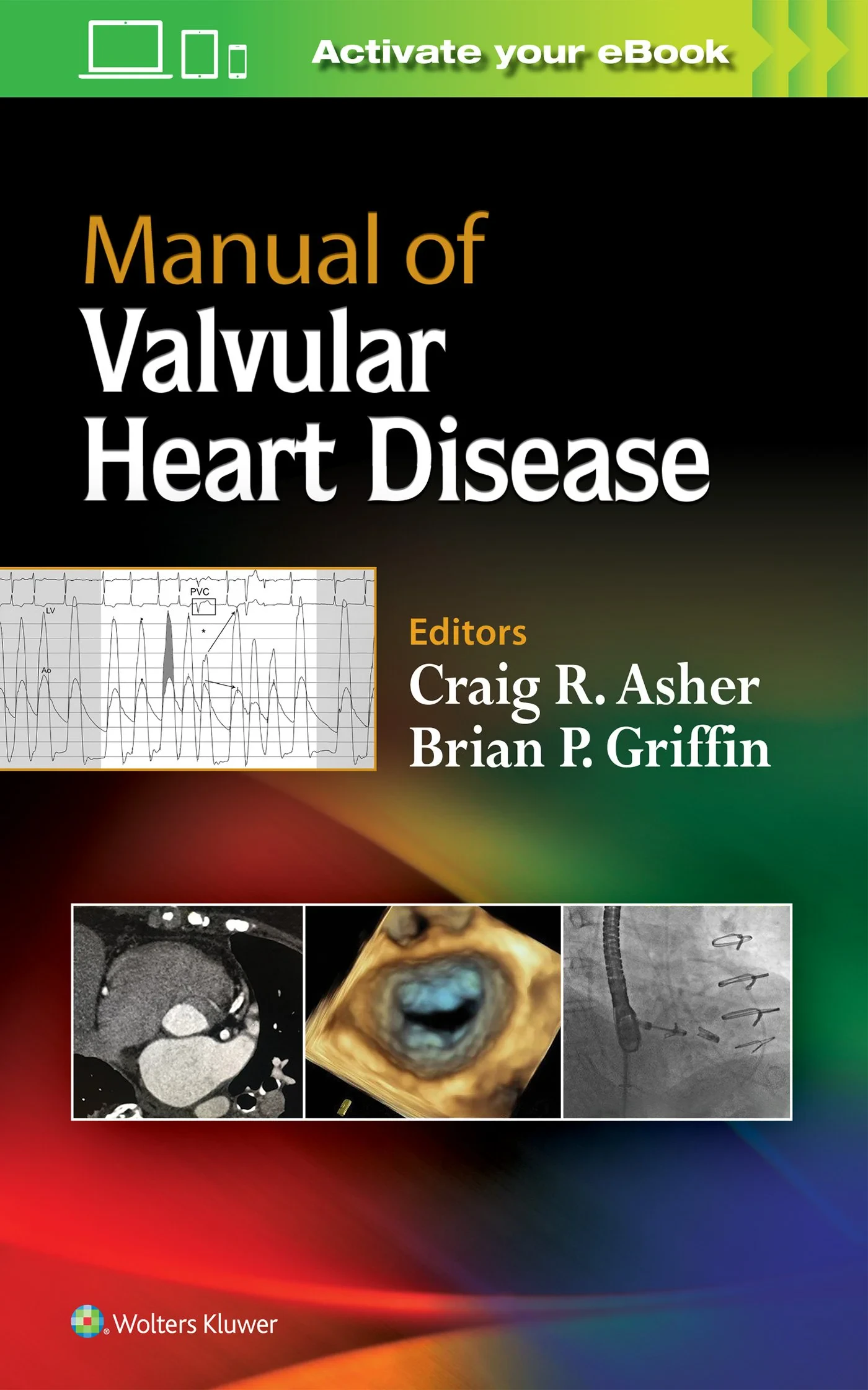 Coperta cărții "Manual of Valvular Heart Disease" de FACC, Craig R. Asher MD, Brian P. Griffin MD