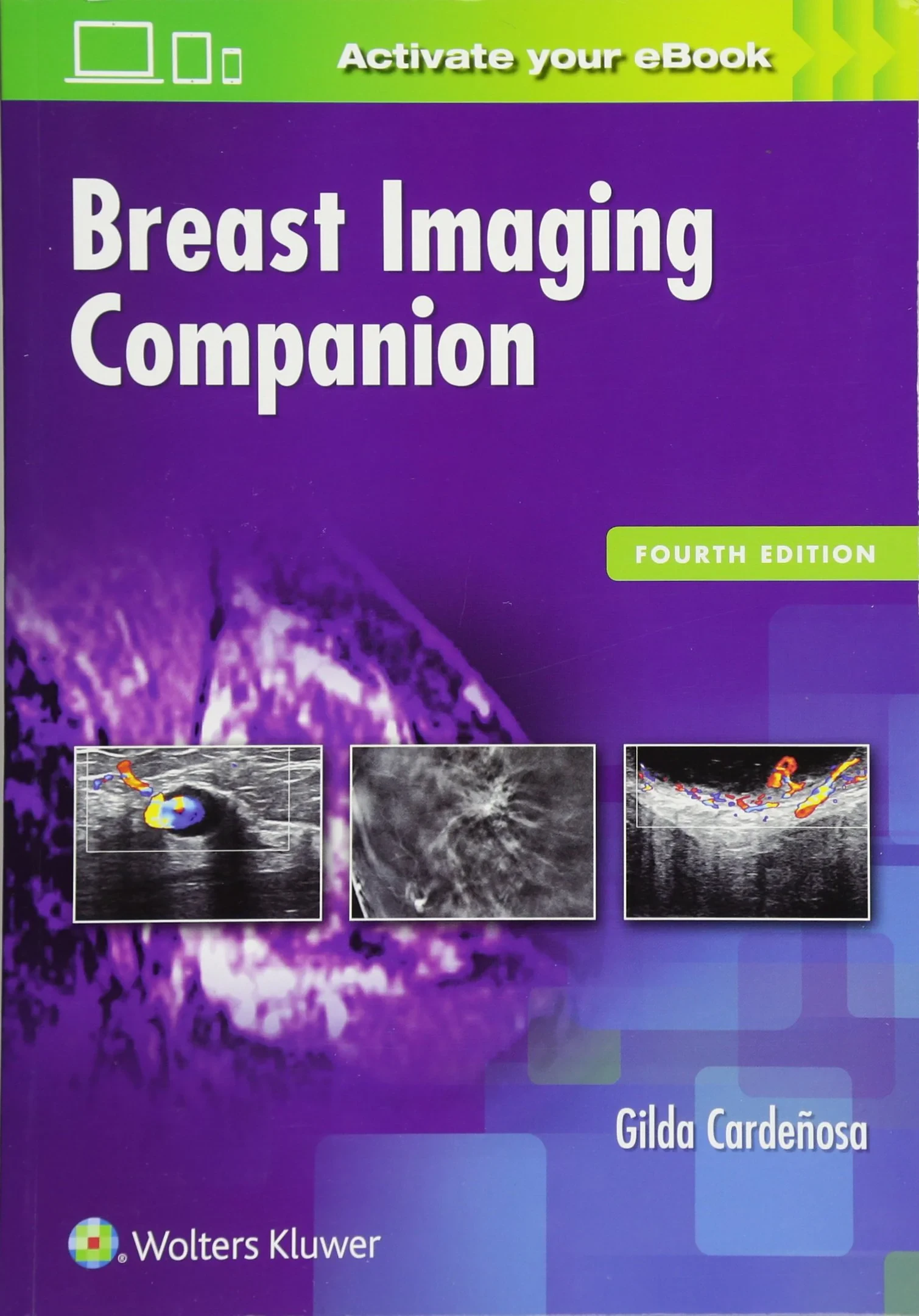 Coperta cărții "Breast Imaging Companion" de CARDENOSA