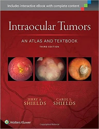 Intraocular Tumors: An Atlas and Textbook Third Ed...
