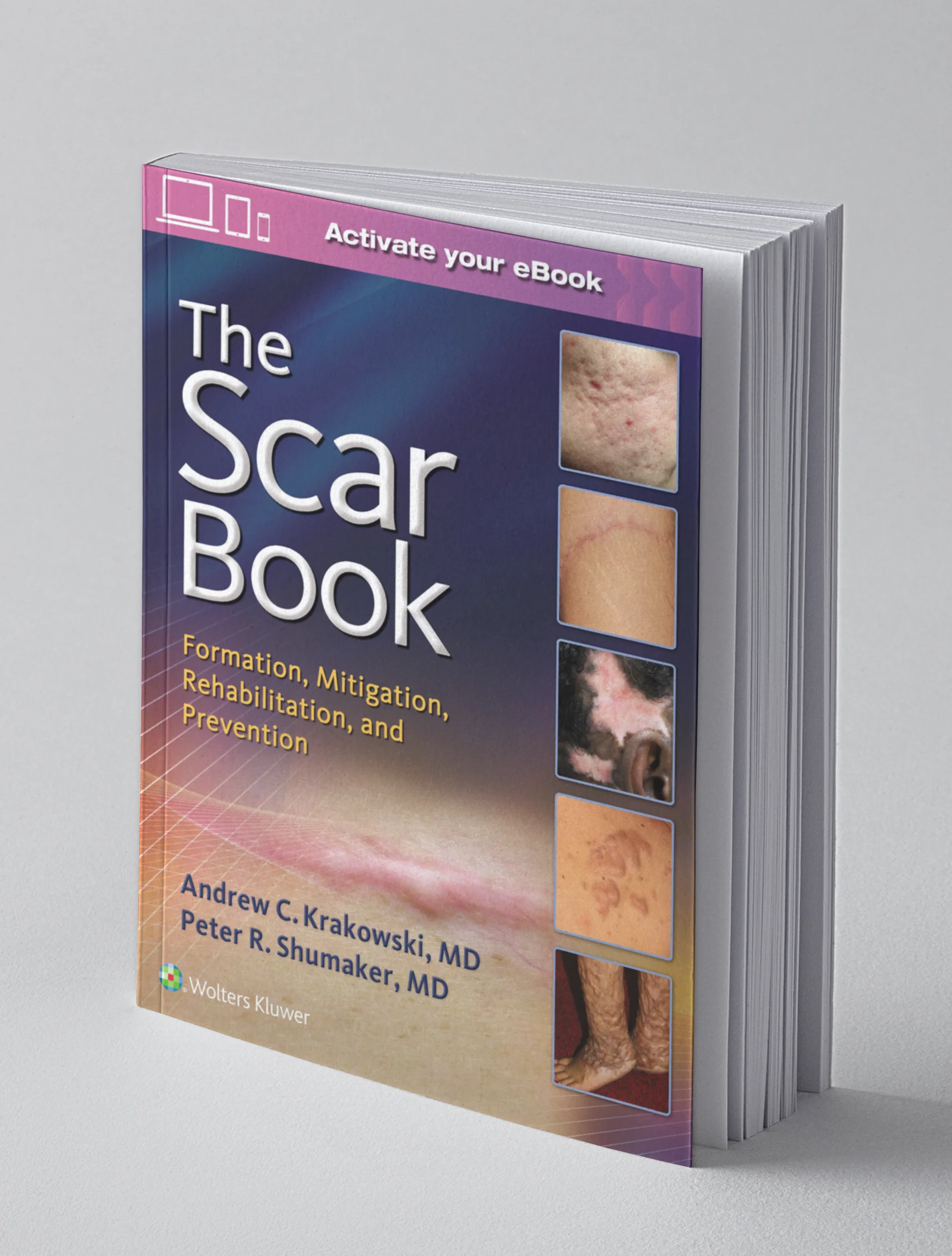 Coperta cărții "The Scar Book: Formation, Mitigation, Rehabilitation and Prevention" de Dr. Andrew C. Krakowski, Dr. Peter R. Shumaker