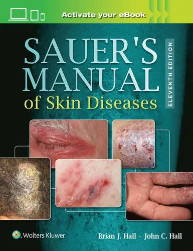 Coperta cărții "Sauer’s Manual of Skin Diseases, 11e " de John C. Hall and Brian J. Hall