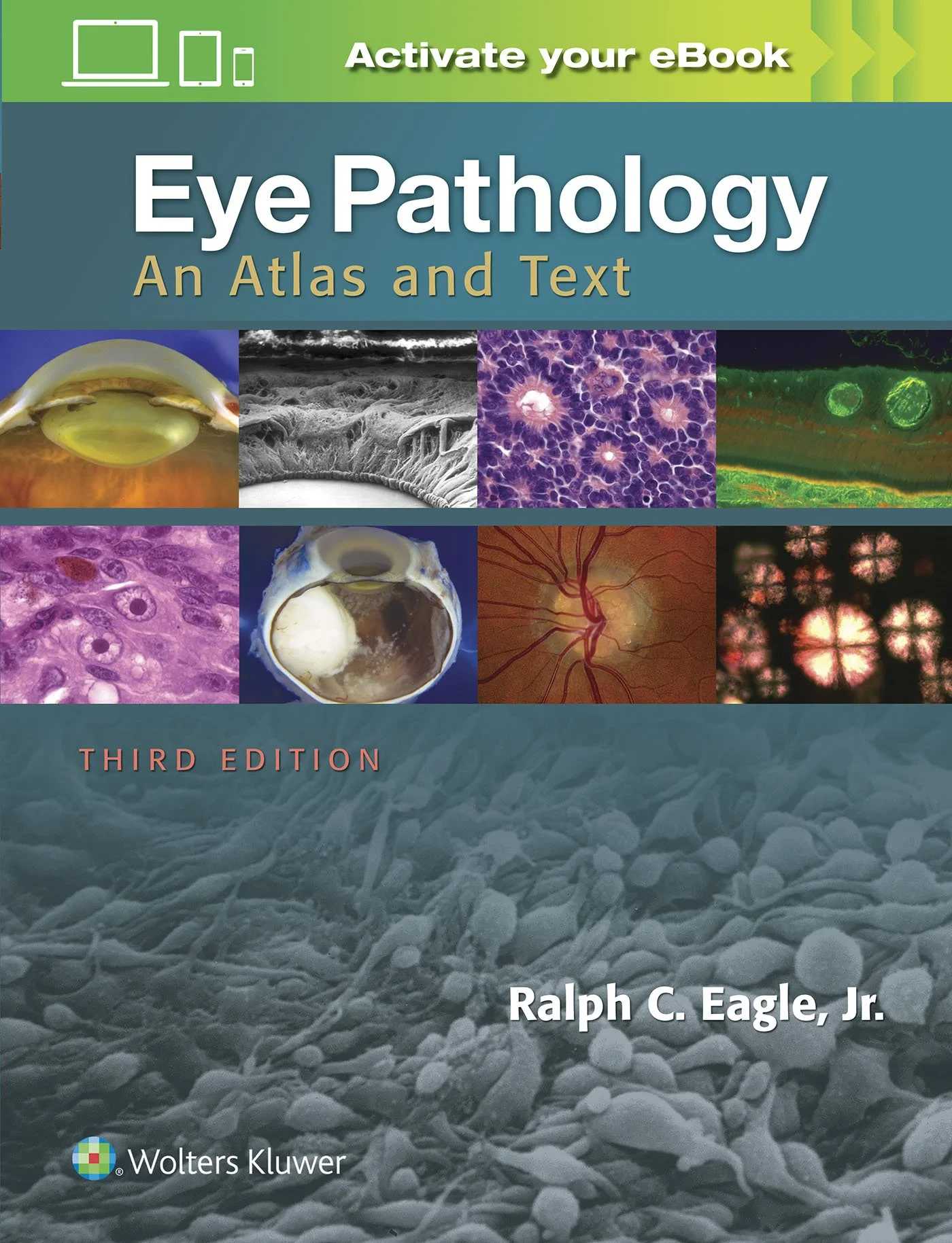 Coperta cărții "Eye Pathology: An Atlas and Text" de Ralph C. Eagle