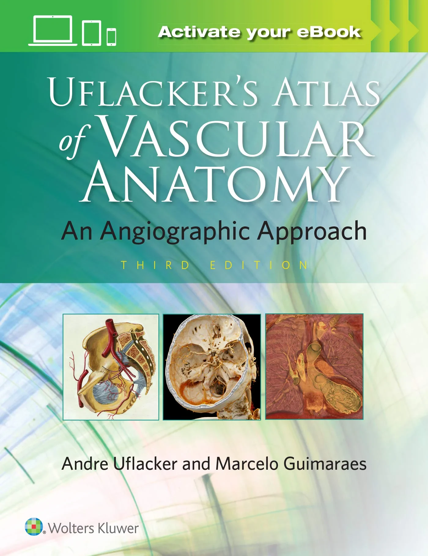 Uflacker’s Atlas of Vascular Anatomy