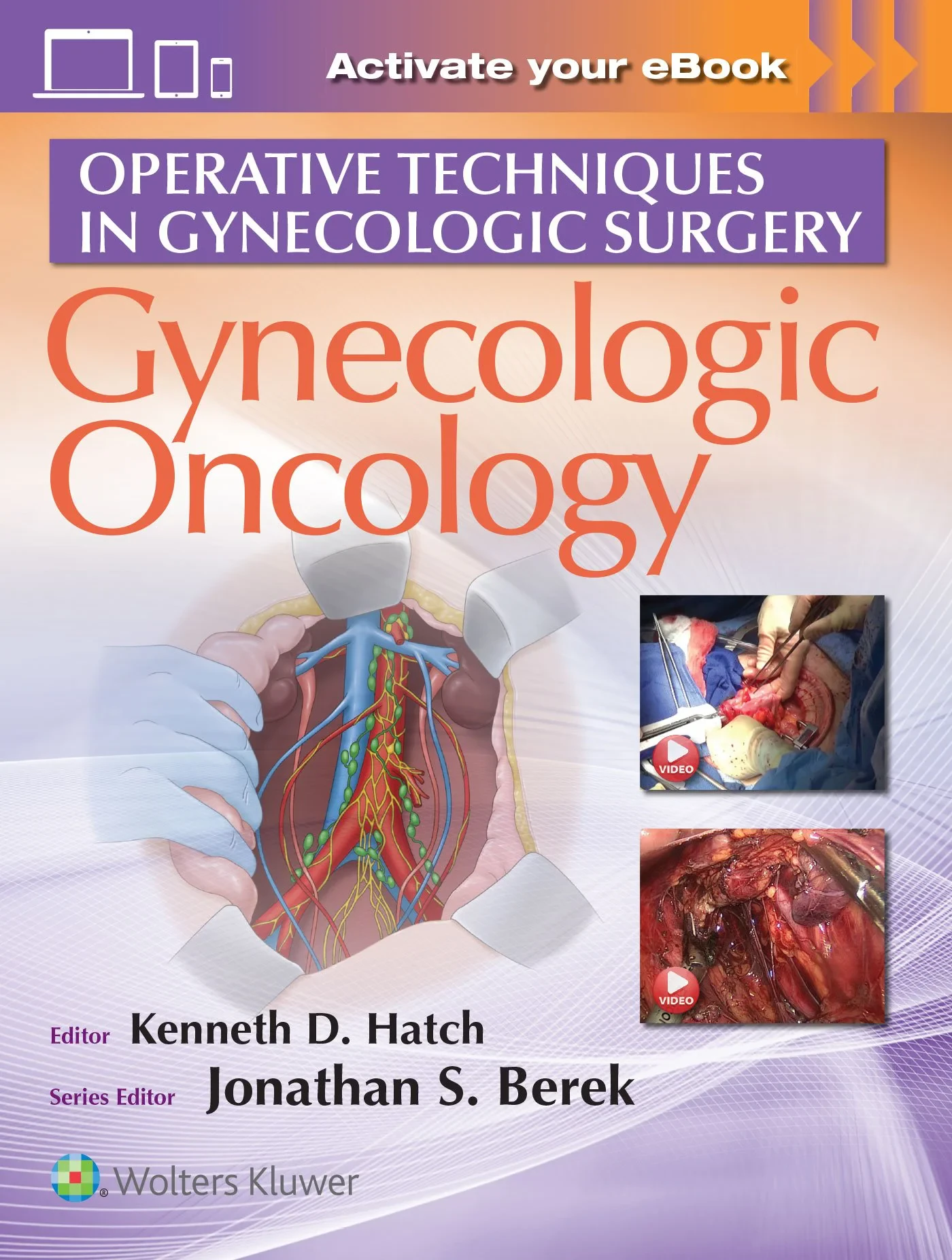 Coperta cărții "Operative Techniques in Gynecologic Surgery: Gynecologic Oncology" de Hatch