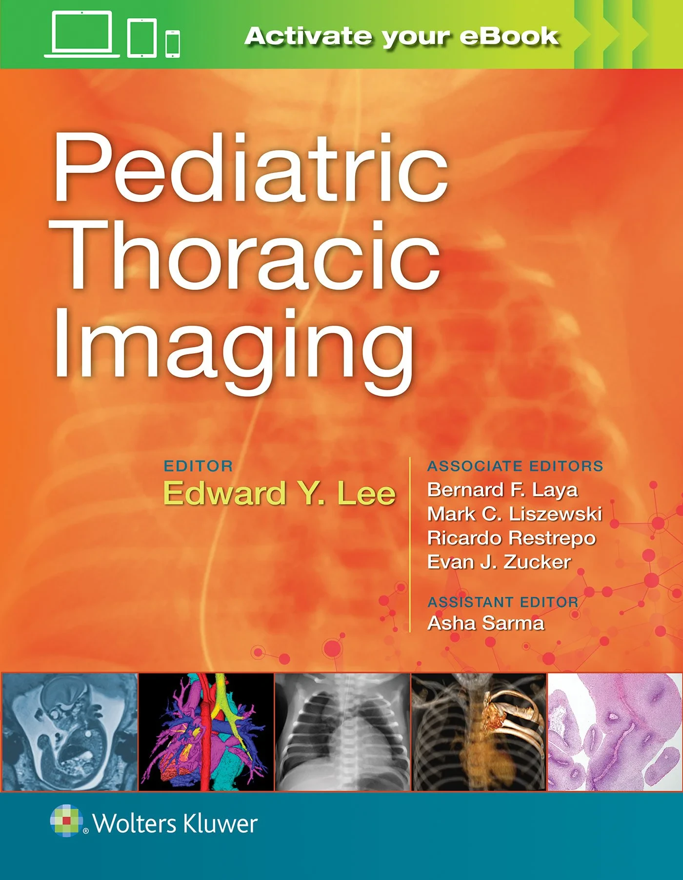Coperta cărții "Pediatric Thoracic Imaging" de Lee
