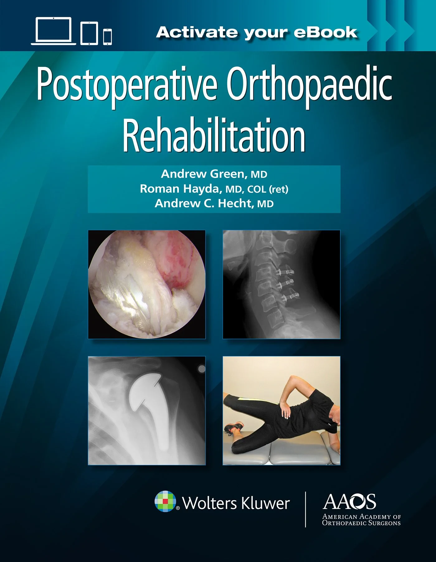 Coperta cărții "Postoperative Orthopaedic Rehabilitation" de Andrew Green, Roman Hayda and Andrew Hecht