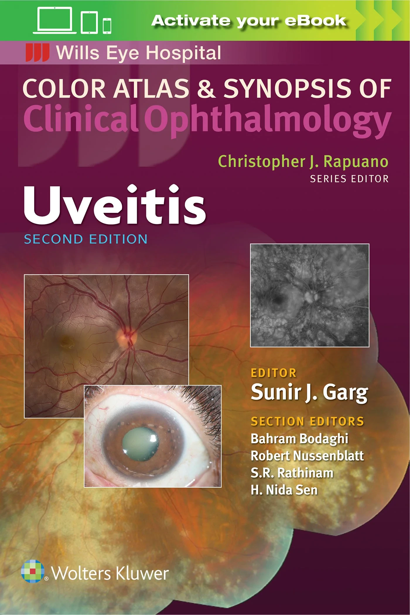Coperta cărții "Uveitis (Color Atlas &amp; Synopsis of Clinical Ophthalmology)" de Sunir J. Garg