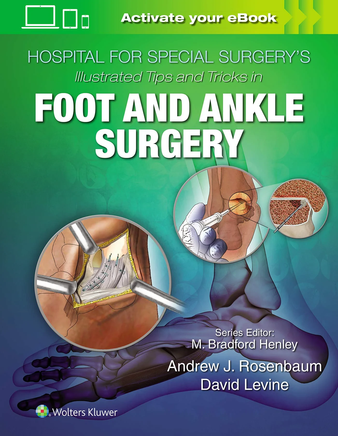 Coperta cărții "Hospital for Special Surgery's Illustrated Tips and Tricks in Foot and Ankle Surgery " de Levine
