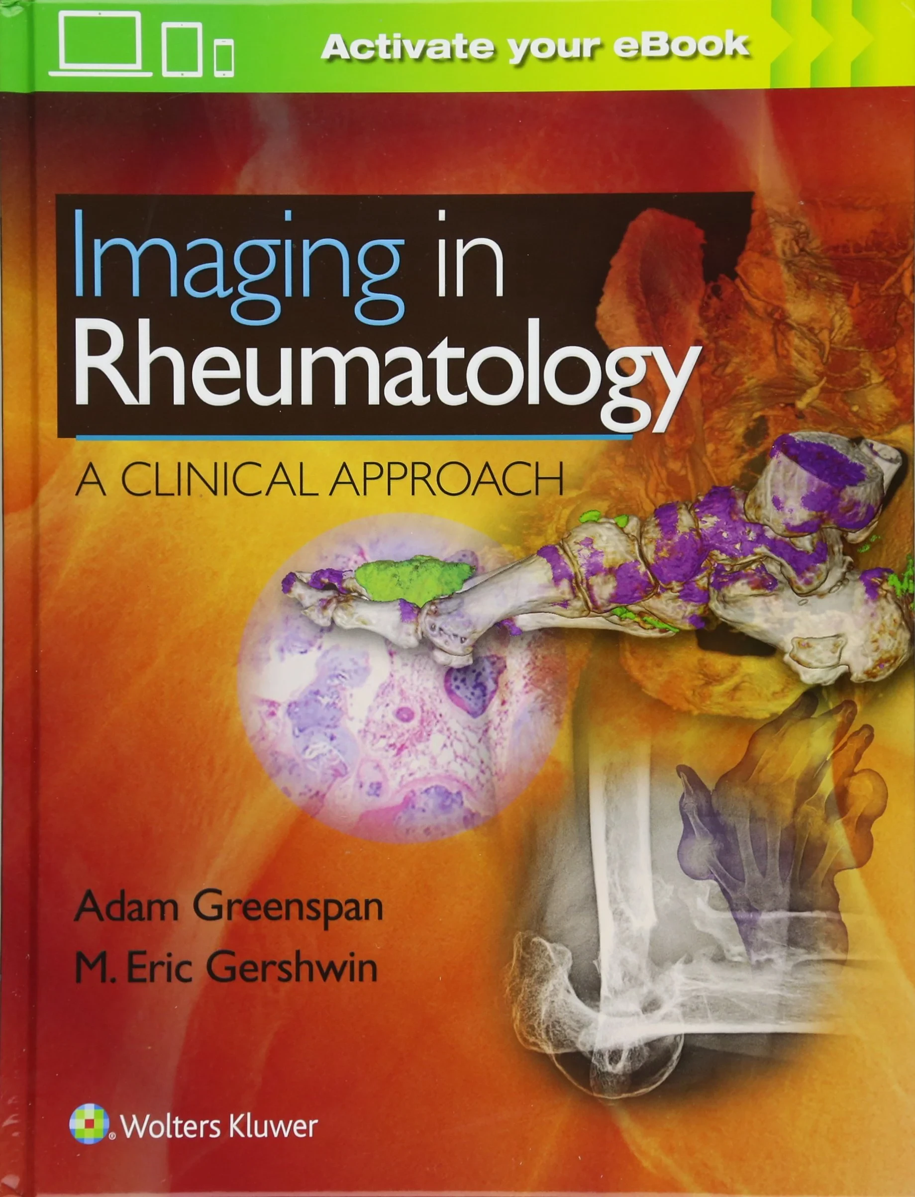 Coperta cărții "Imaging in Rheumatology: A Clinical Approach" de Adam Greenspan, M. Eric Gershwin