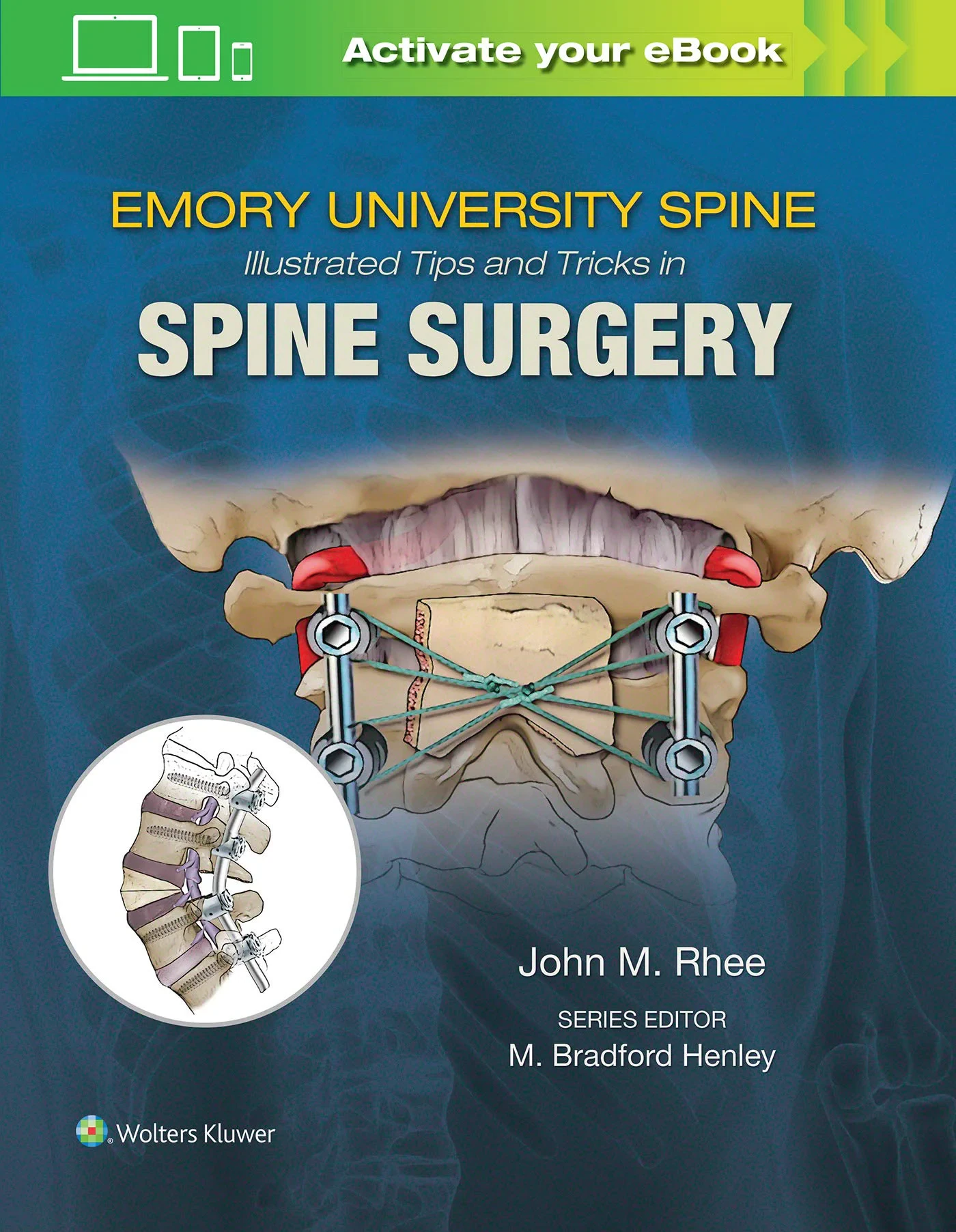 Coperta cărții "Emory’s Illustrated Tips and Tricks in Spine Surgery" de John Rhee