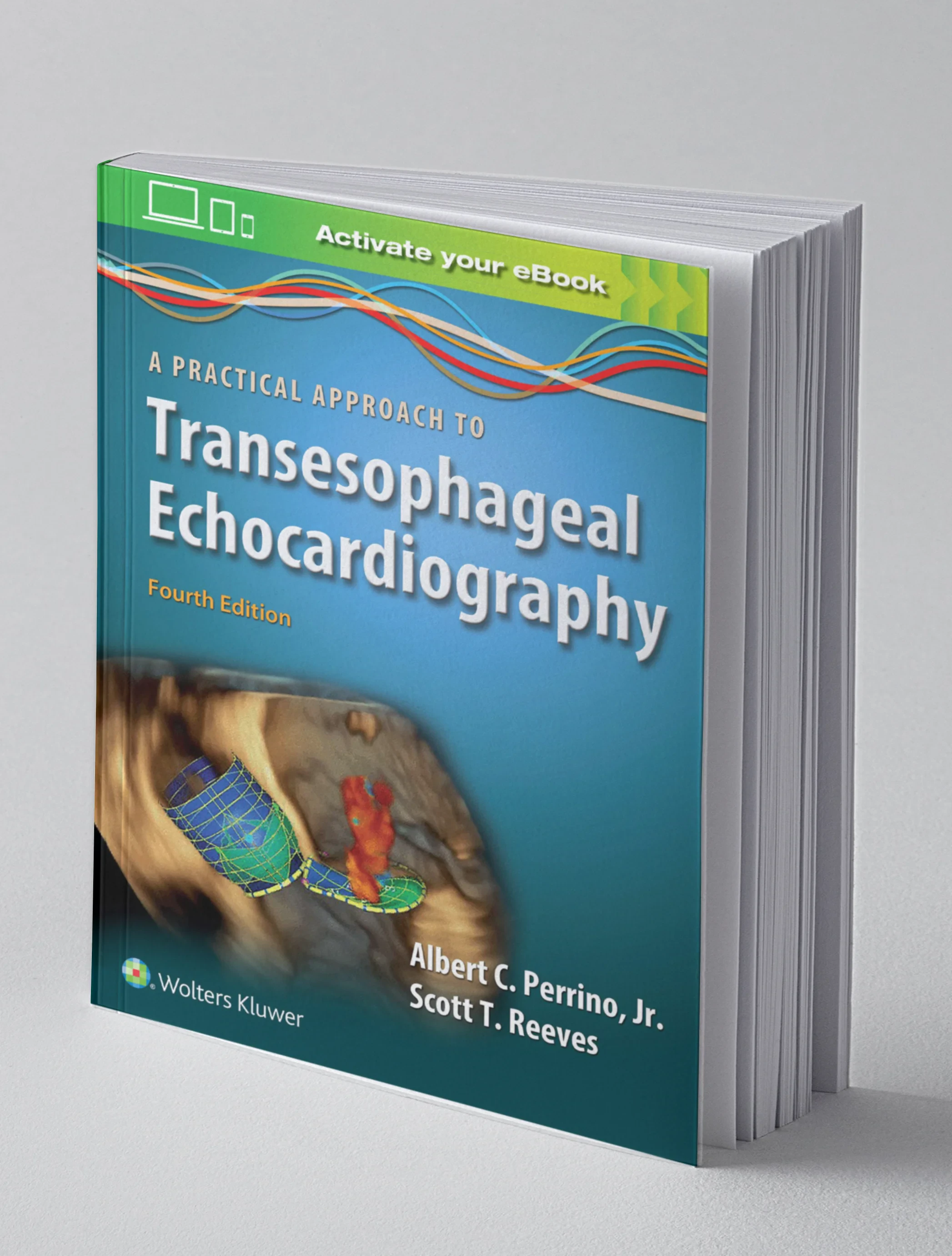 Coperta cărții "A Practical Approach to Transesophageal Echocardiography" de Albert C. Perrino, Scott T. Reeves