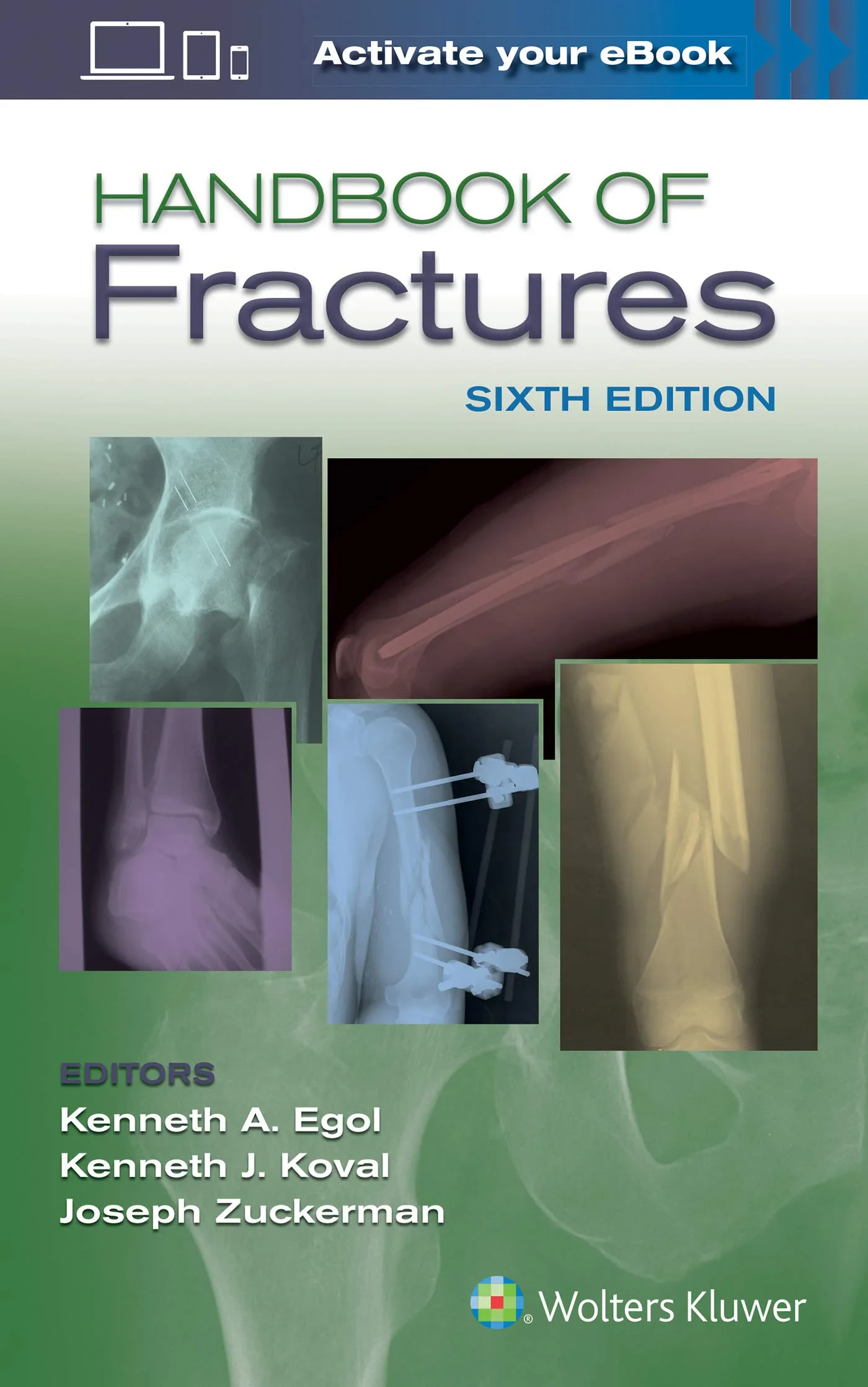 Coperta cărții "Handbook of Fractures " de Kenneth Egol MD