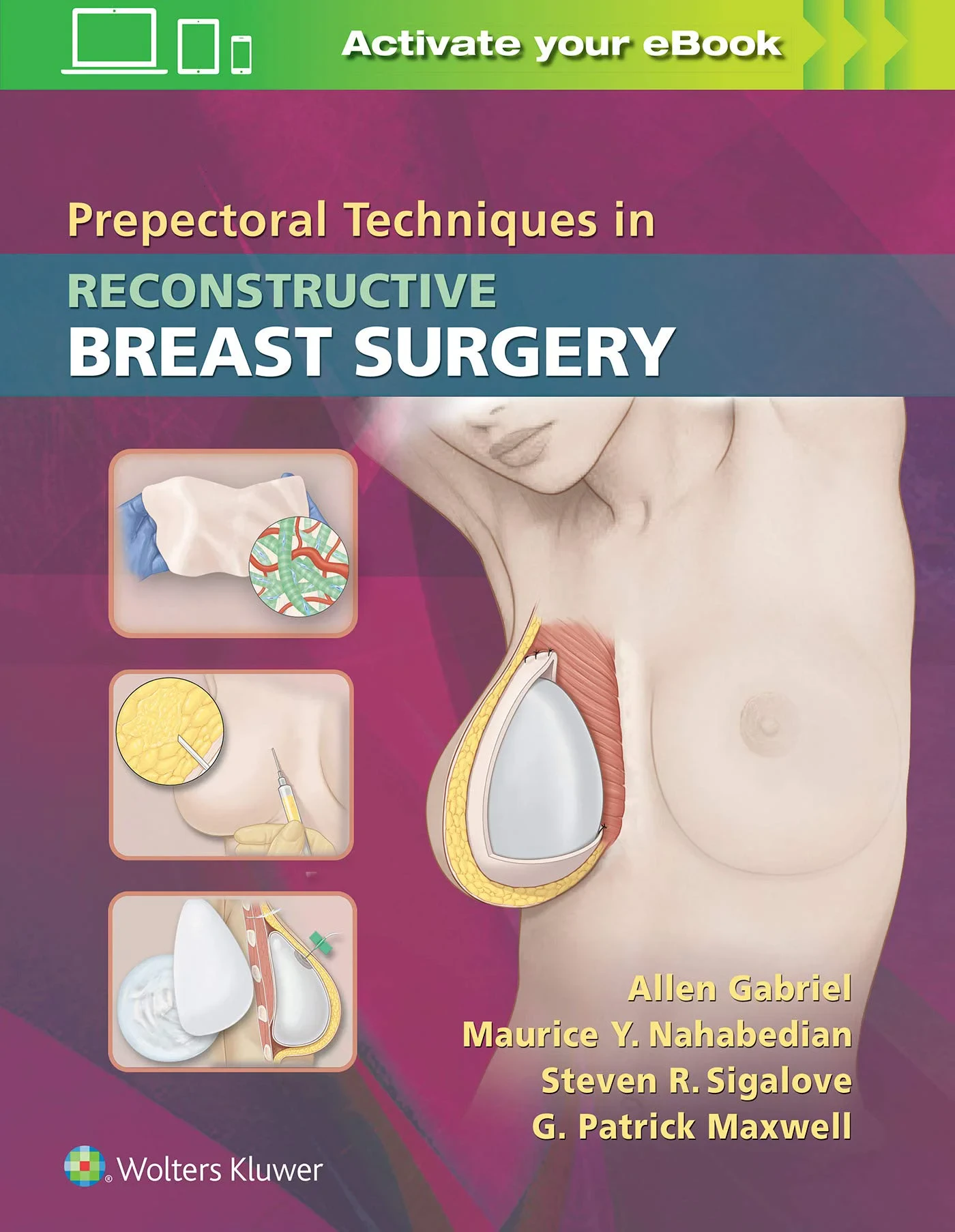 Coperta cărții "Prepectoral Techniques in Reconstructive Breast Surgery" de FACS, Allen Gabriel MD, Maurice Y. Nahabedian MD, Steven R Sigalove MD, G. Patrick Maxwell MD