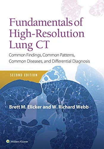 Coperta cărții "Fundamentals of High-Resolution Lung CT: Common Findings, Common Patterns, Common Diseases and Differential Diagnosis" de Elicker, Brett M, W. Richard Webb