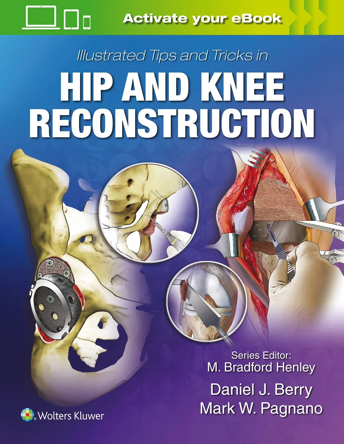 Coperta cărții "Illustrated Tips and Tricks in Hip and Knee Reconstructive and Replacement Surgery " de Daniel J. Berry, Mark W. Pagnano