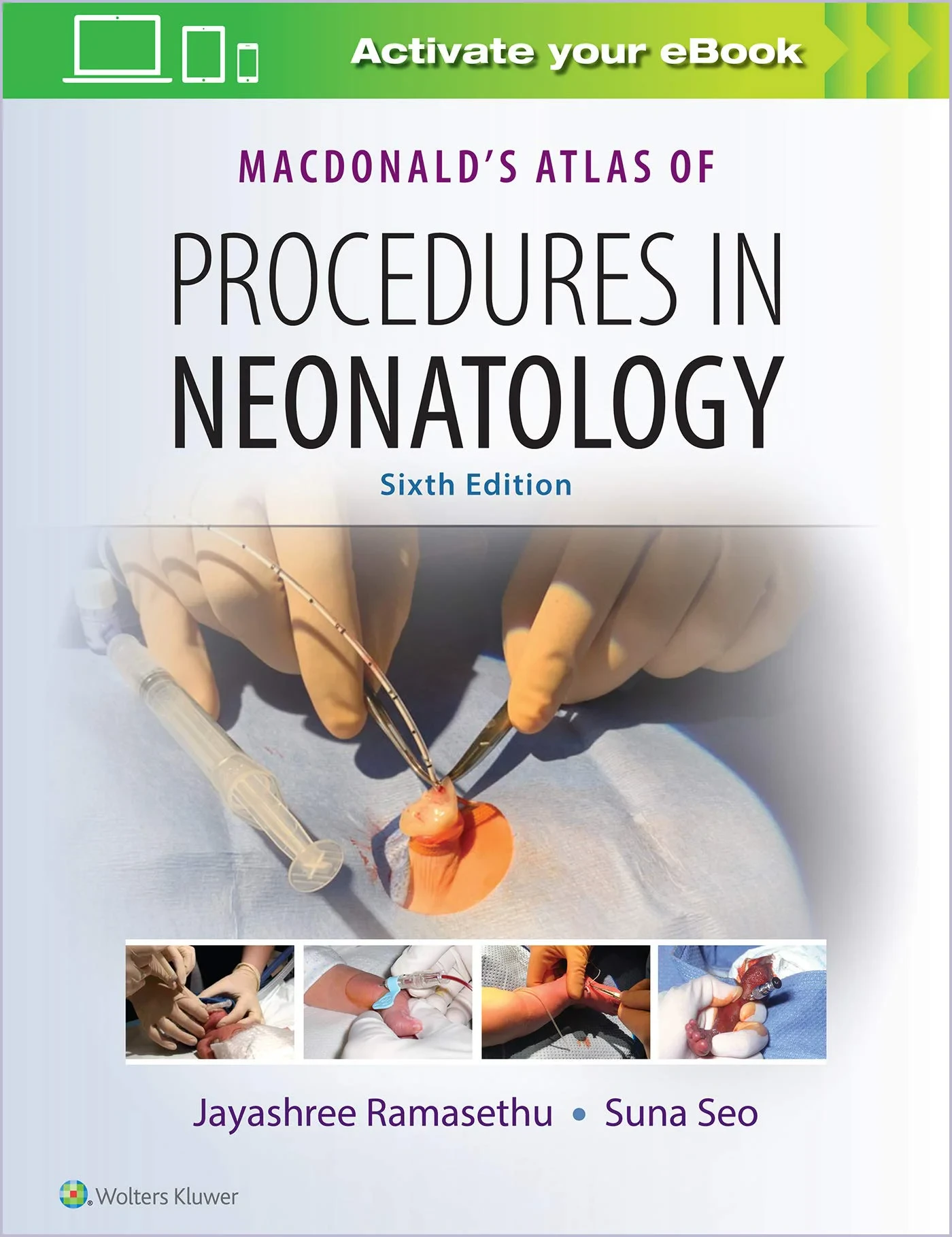 Coperta cărții "MacDonald’s Atlas of Procedures in Neonatology" de Jayashree Ramasethu and Suna Seo