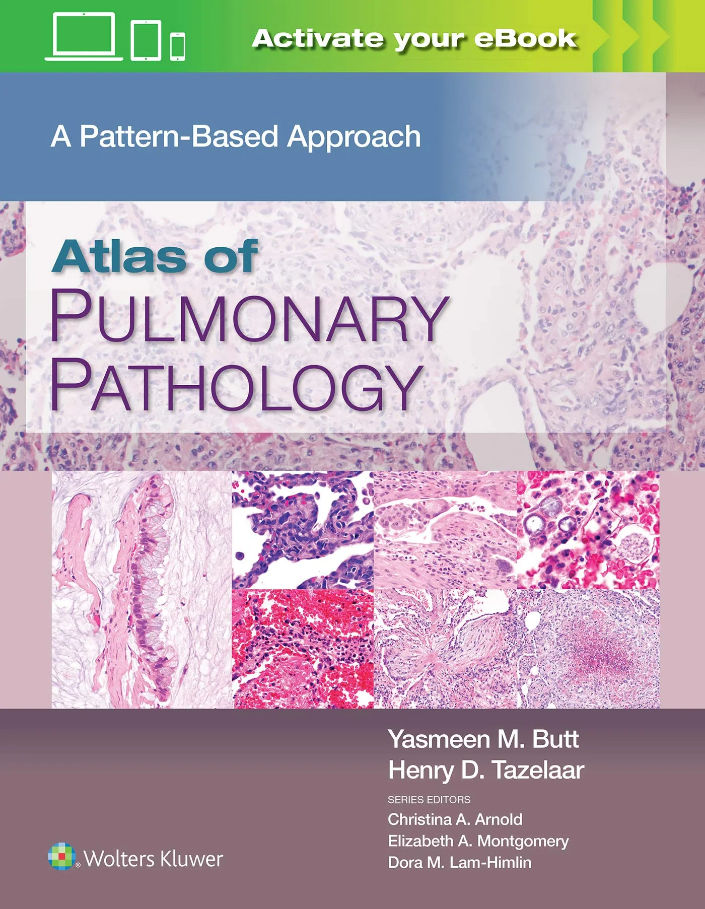 Atlas of Pulmonary Pathology: A Pattern Based Appr...