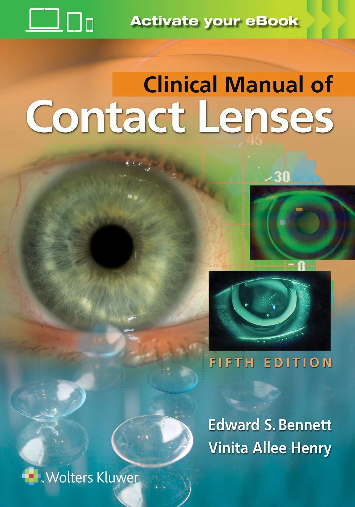 Coperta cărții "Clinical Manual of Contact Lenses " de Edward S. Bennett OD, Vinita Allee Henry OD
