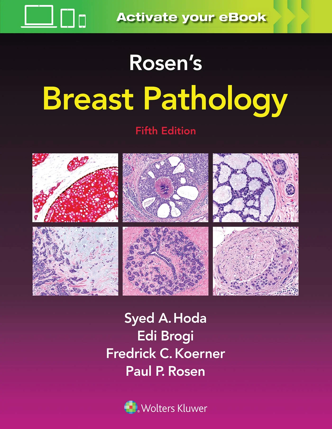 Rosen’s Breast Pathology