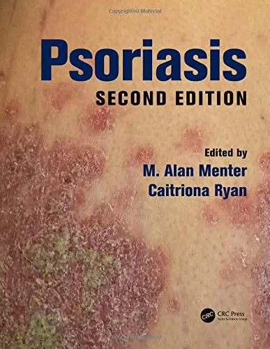 Coperta cărții "Psoriasis, Second Edition " de M. Alan Menter, Caitriona Ryan
