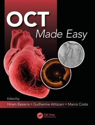 Coperta cărții "OCT Made Easy" de Guilherme F. Attizzani, Hiram G. Bezerra, Marco A. Costa