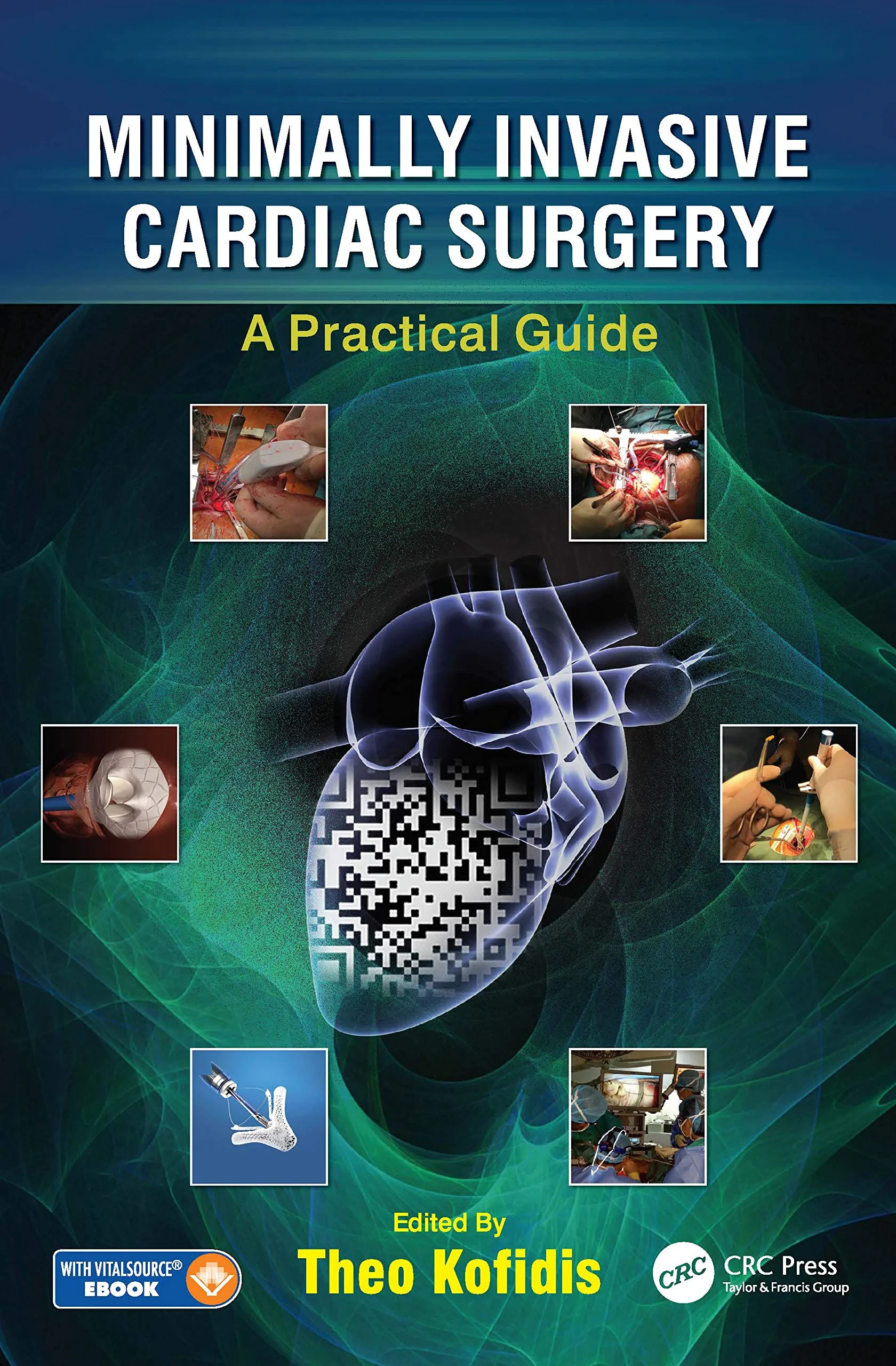 Coperta cărții "Minimally Invasive Cardiac Surgery: A Practical Guide" de Theo Kofidis