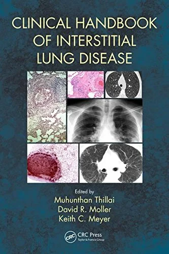 Coperta cărții "Clinical Handbook of Interstitial Lung Disease" de Muhunthan Thillai, David R. Moller, Keith C. Meyer