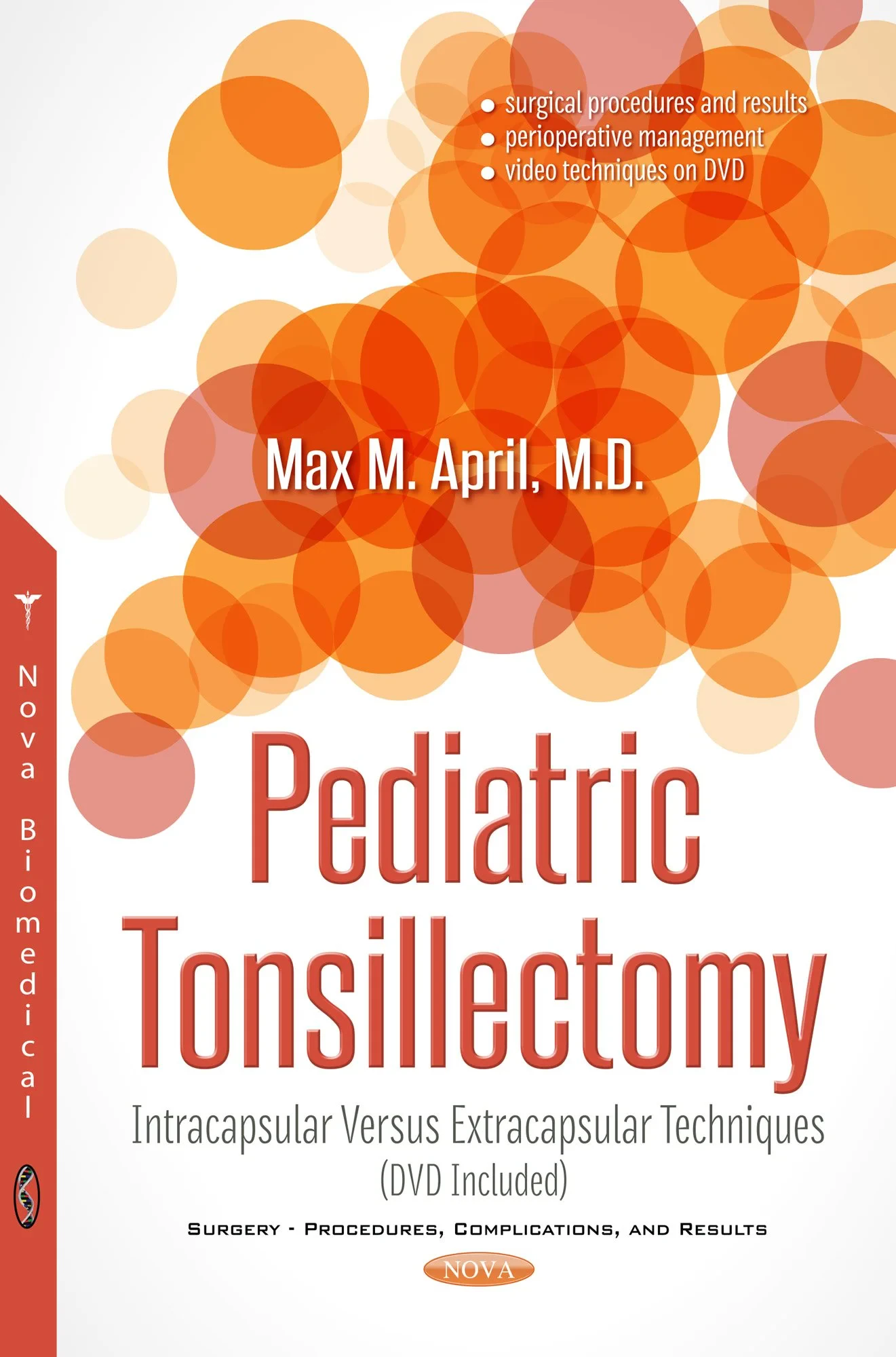 Coperta cărții "Pediatric Tonsillectomy: Intracapsular Versus Extracapsular Techniques (Surgery Procedures Complicatio)" de Max M April