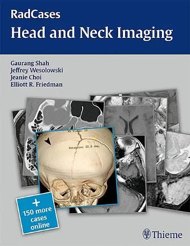 Coperta cărții "Head and Neck Imaging (Radcases Plus Q&amp;A)" de Gaurang Vrindavan Shah, Jeffrey Robert Wesolowski