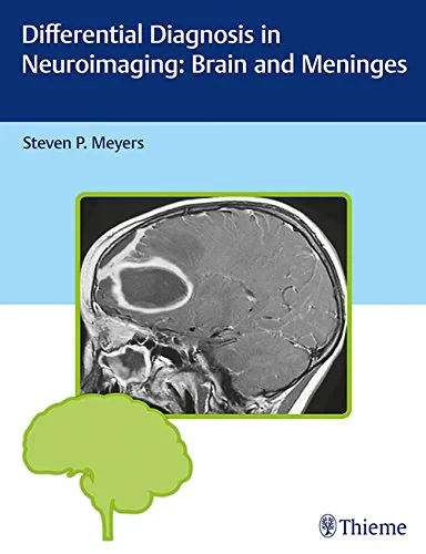 Coperta cărții "Differential Diagnosis in Neuroimaging: Brain and Meninges" de Steven P. Meyers
